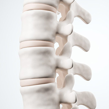 Orthopäde Wirbelsäule